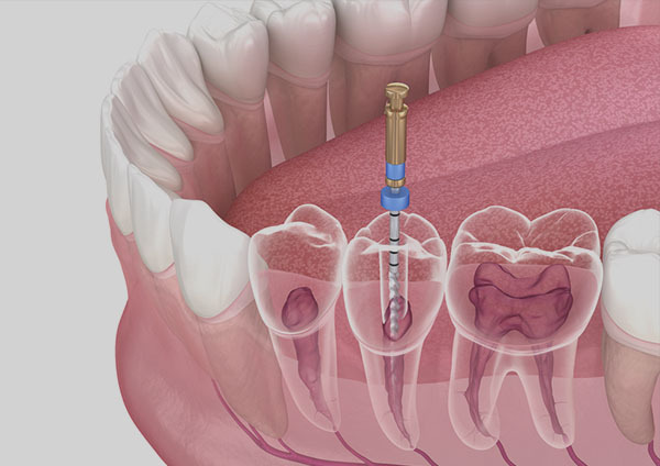 Kids Dental Clinic in RR Nagar