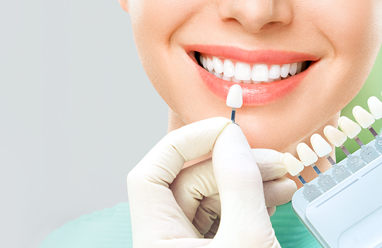 Cosmetic Dentistry in RR Nagar