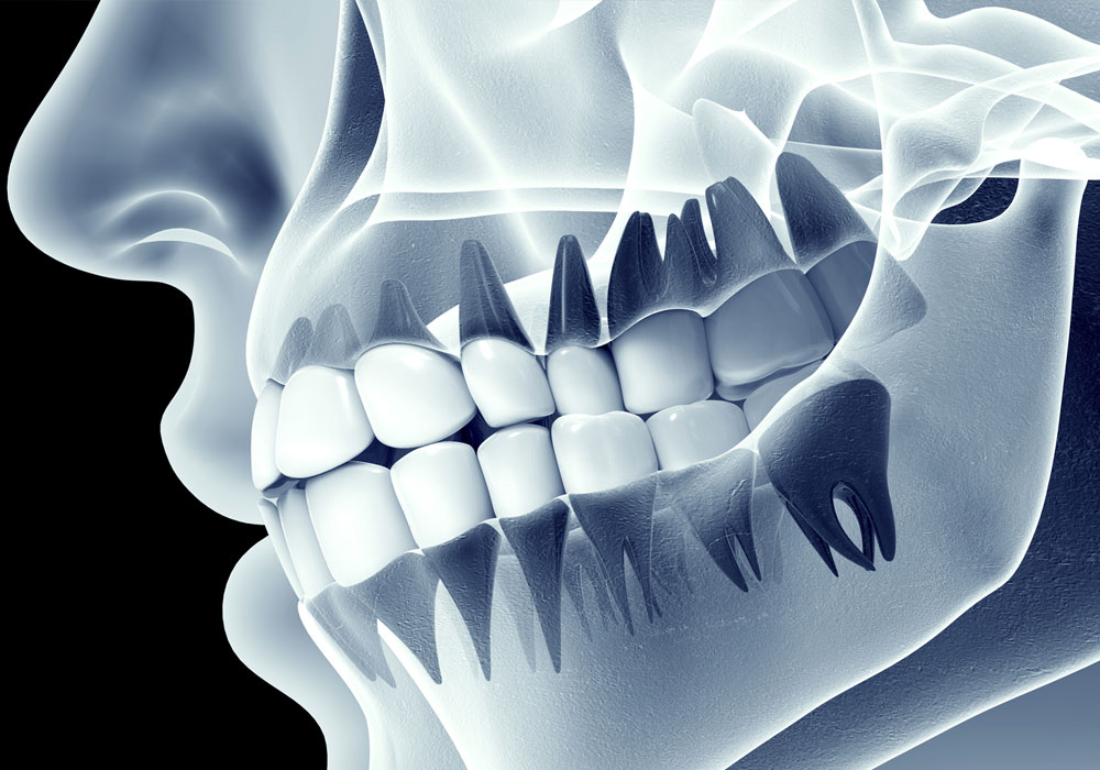 Dental X Ray Centres in RR Nagar