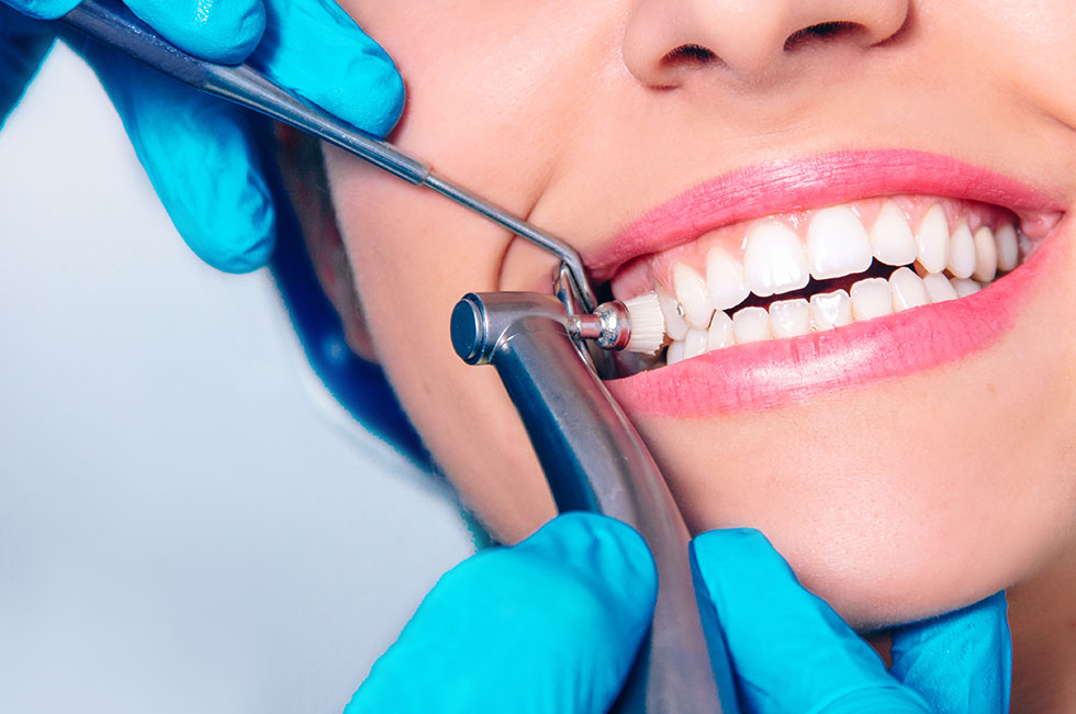 Best Teeth Cleaning in RR Nagar